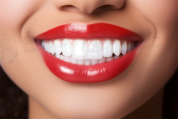 杭州德贝口腔门诊部(DB口腔)推出活动义齿价格，原价2980元起，现优惠仅需2380元起，让您在享受优质口腔服务的同时，轻松掌握价目表，省钱又安心！