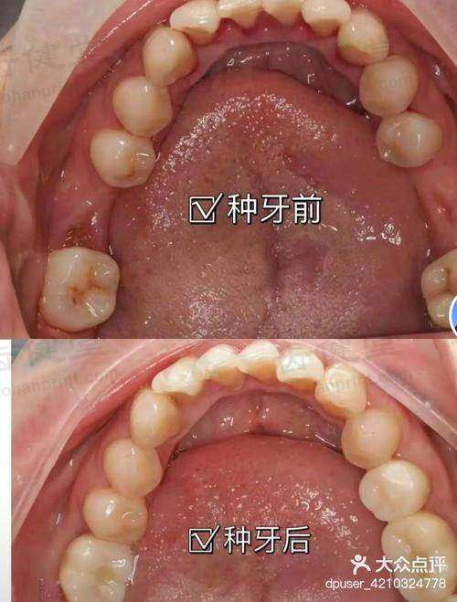 南充德美牙科诊所的挂号方式与地址