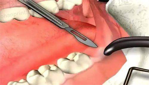 精良设备保护诊疗服务