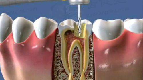 三明美达齿科口腔价目表详情