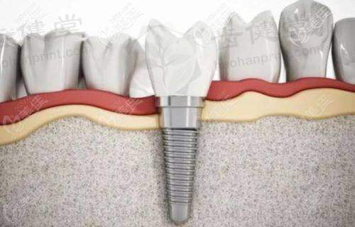 总结与行动指引