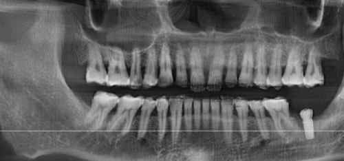 姜海滨医生：坐诊辽宁佳美口腔友好门诊