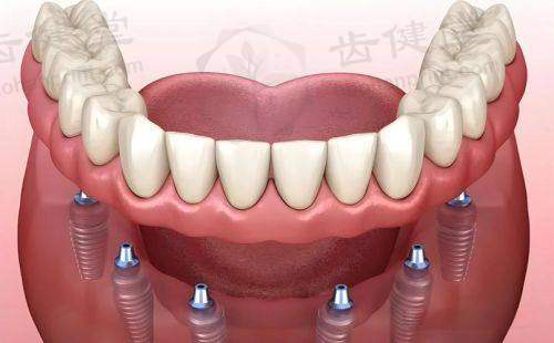 达州华美口腔医院与吕映海医生的协同优势