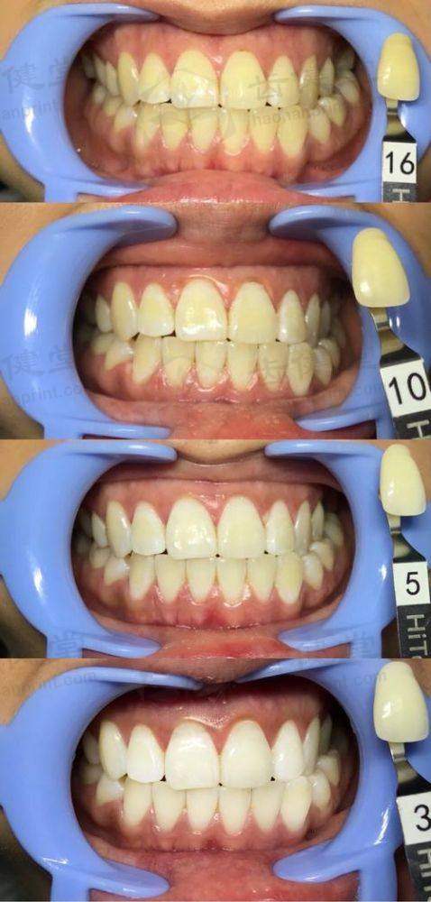 吕映海医生的专精实力