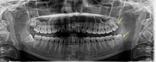 总结与行动指引