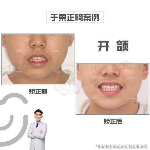 孙婧婧医生:正畸领域的专精担当