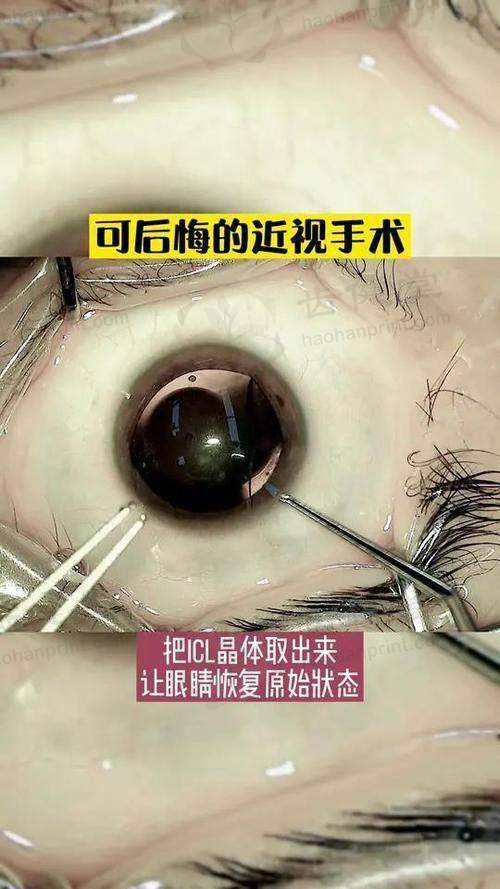 通用环球中铁西安医院眼科