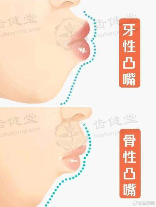 擅长项目详解
