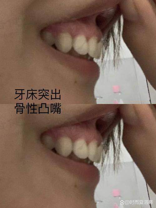 预约优惠活动
