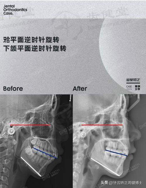 临床实例分享