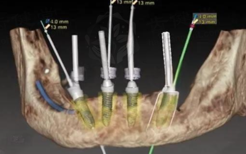  佛山市南海区中医院口腔科医生团队（部分）：