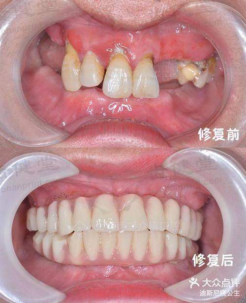 佛山市南海区中医院口腔科擅长项目