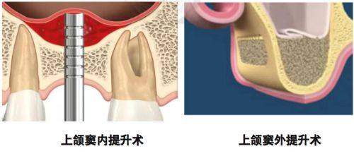 佛山市南海区中医院口腔科乘车路线：