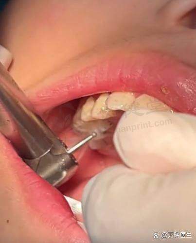 佛山市南海区中医院口腔科预约挂号