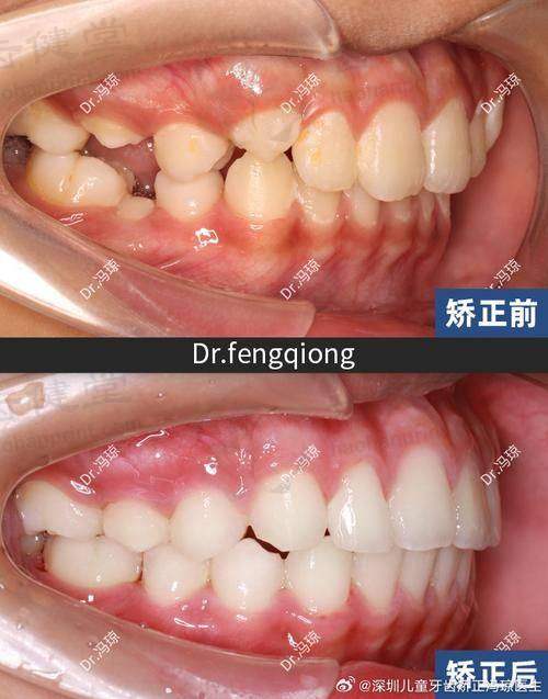 优惠活动详情