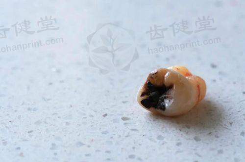 三亚泰康拜博口腔医院姜雅欣医生擅长项目