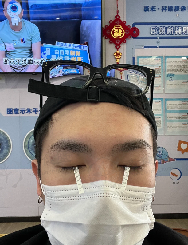 被眼镜困扰多年，我在珠海希玛做完飞秒，后悔没早做！ 