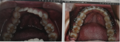 1 元抢！福州维乐口腔门诊部（中亭街总店）【1 - 13 岁】儿童牙齿全面检查