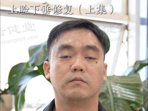 石家庄爱眼医院眼科上班时间：