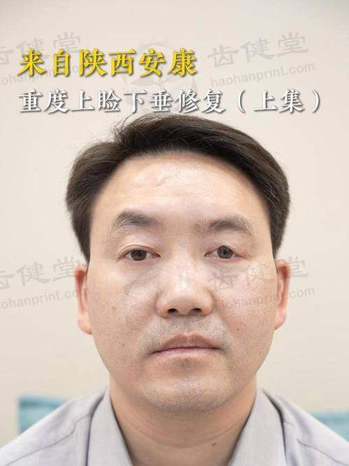 石家庄爱眼医院眼科口碑评价与项目分享：