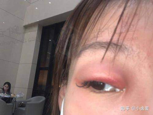 石家庄爱眼医院眼科擅长项目