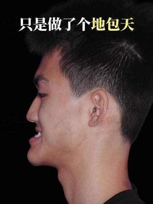 潍坊潍城郭兰口腔收费价格表