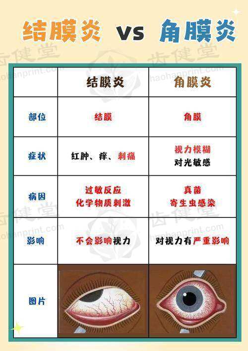郑州大学附属第五医院眼科