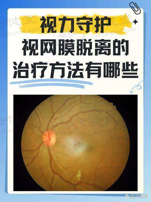 保山腾冲视明眼科医院