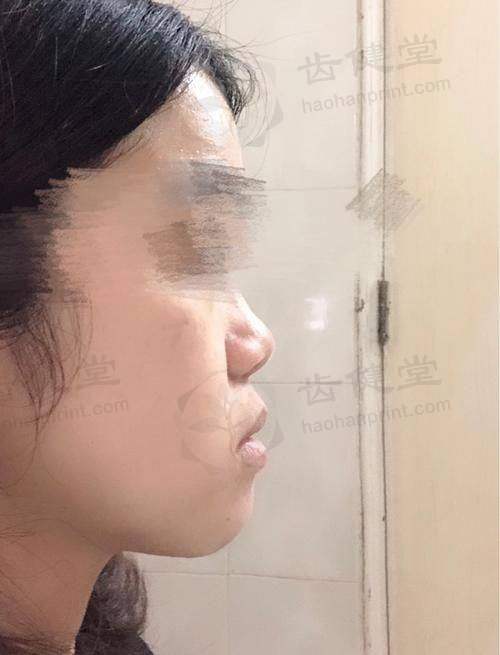 优惠活动详情