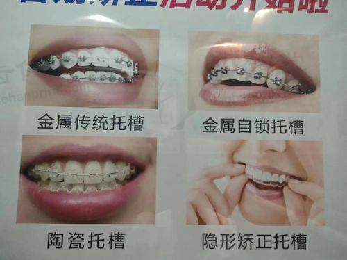服务流程