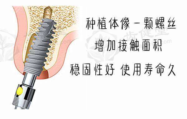 广州德伦口腔门诊部(东风总院)冯翠娟靠谱吗？本地专家经验丰富，正畸有保障