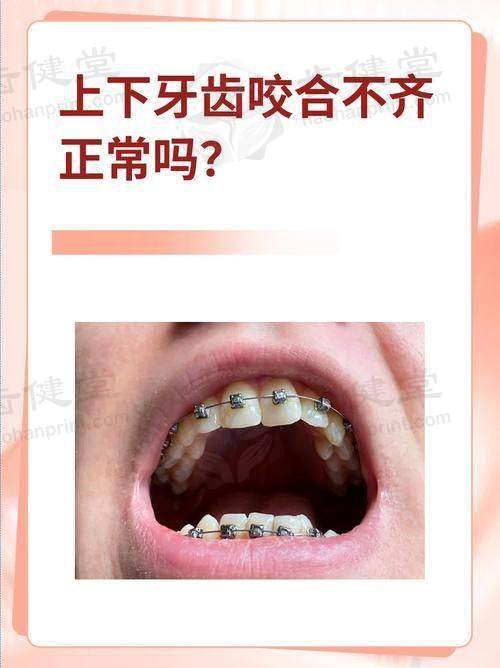 贵州医 科 大学附属口腔医院口腔正畸科擅长项目