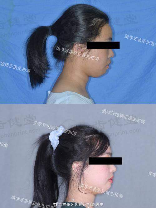 贵州医 科 大学附属口腔医院口腔正畸科收费价格表