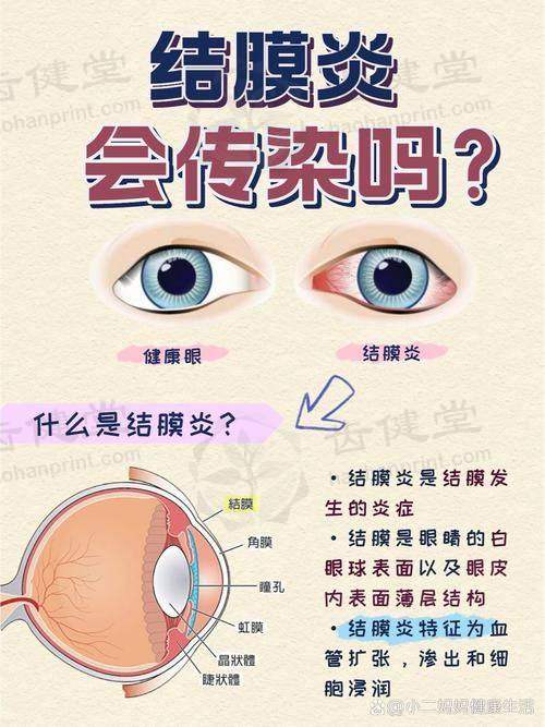 优惠活动详情