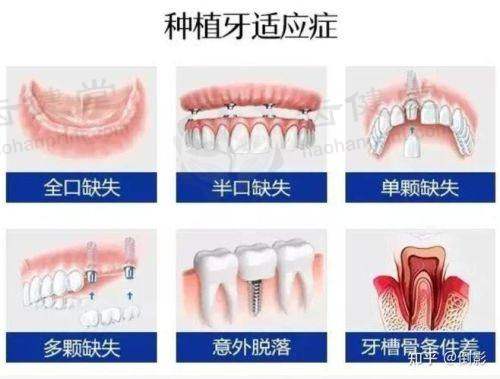 优惠活动详情