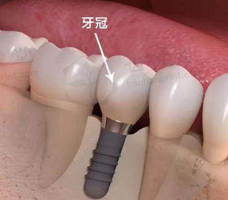 济宁壹颗芽口腔门诊部