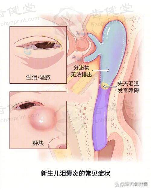 锦州市中 心医院亚东眼病医院怎么样正规吗？