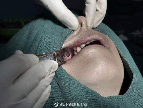 优惠活动详情