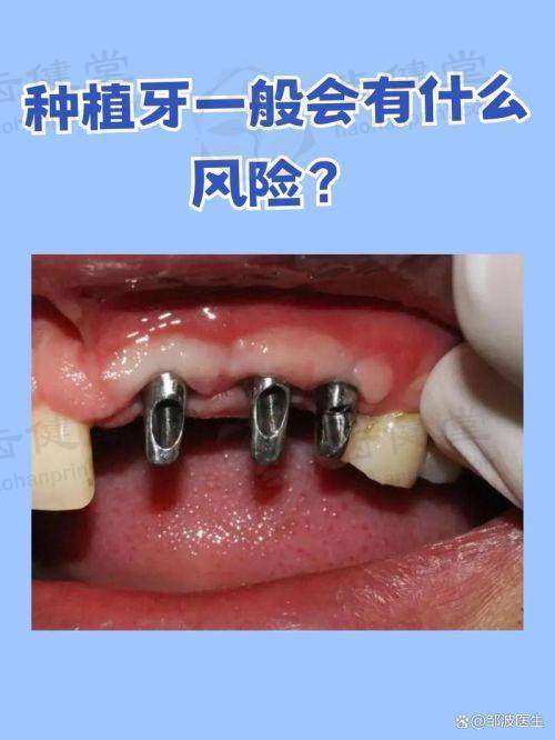 涟水碧清口腔预约挂号