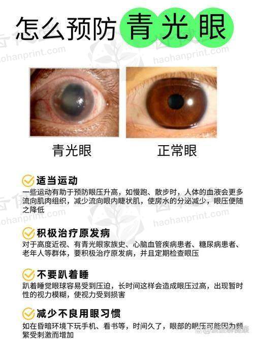 优惠活动详情