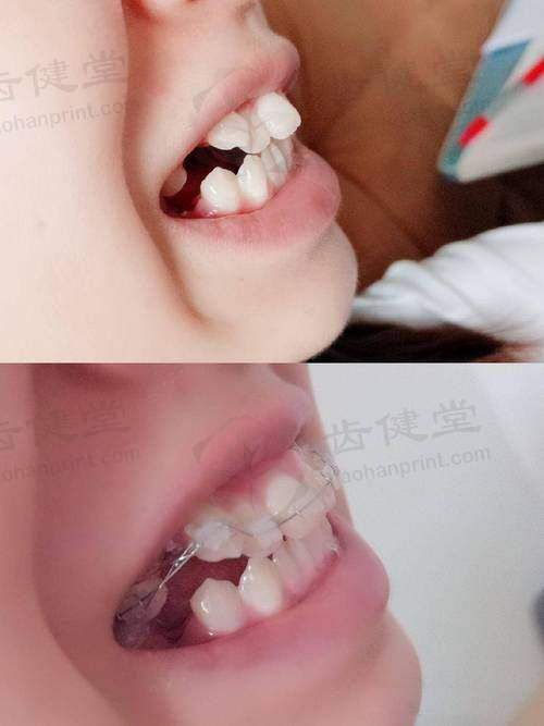 结尾预约号召