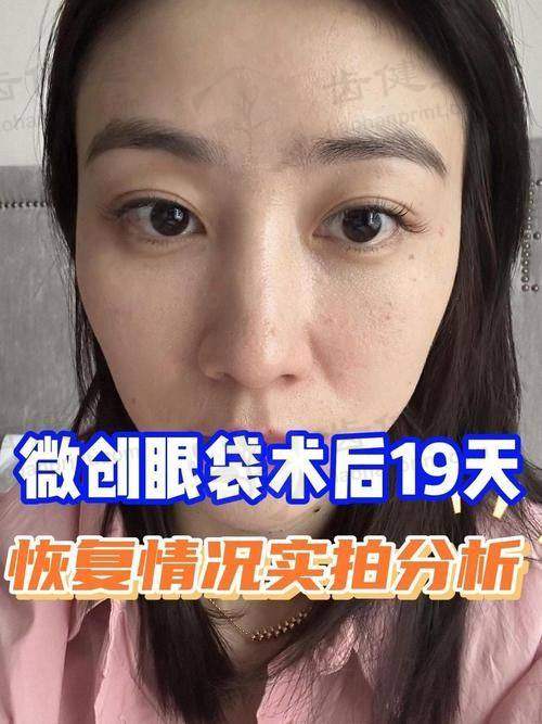 擅长项目详解