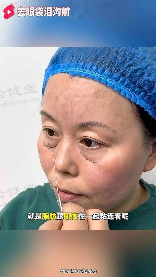 临床实例分享