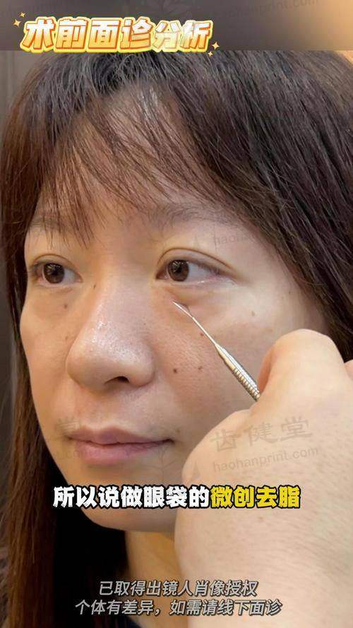 患者真实评价