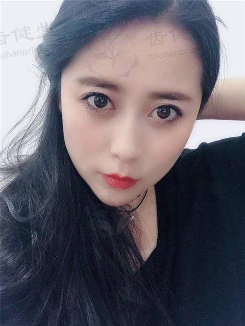 擅长项目详解