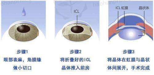 河源东江眼科