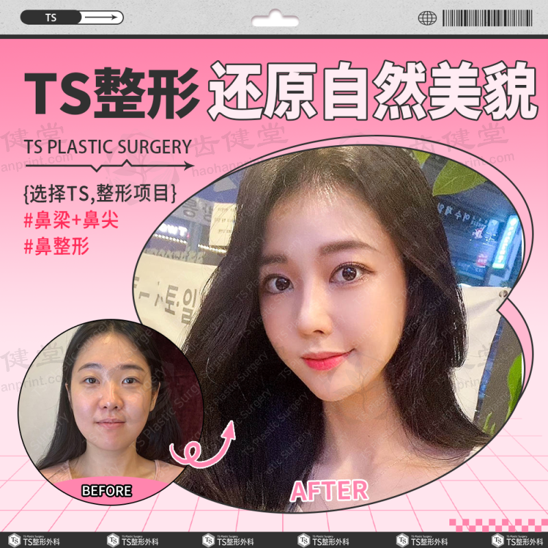韩国TS整形医院权侑霞怎么样预约挂号？两种便捷预约方式揭秘