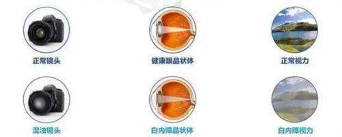 中南大学湘雅医院眼科口碑评价与实例分享