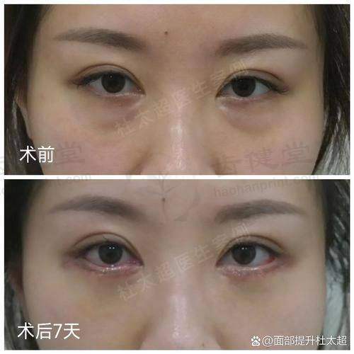 预约优惠活动