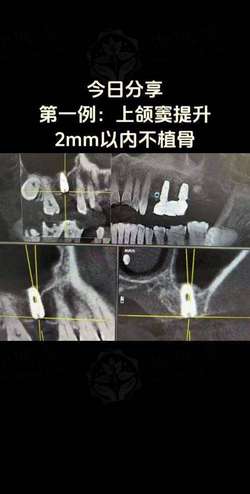 江苏泰州靖江元泰综合口腔口碑评价与实例分享
